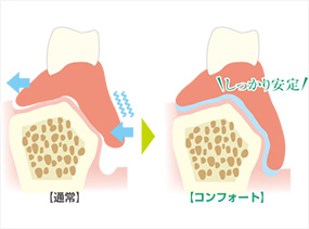 コンフォート ソケット