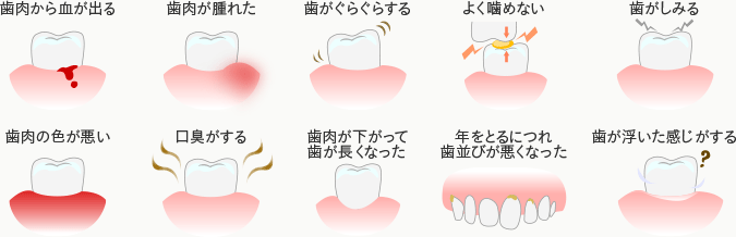 歯周病の症状